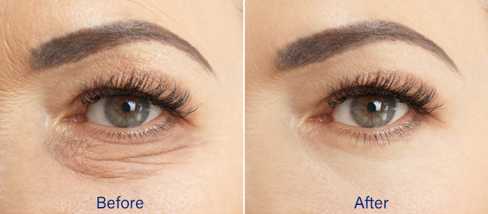 Before and After images