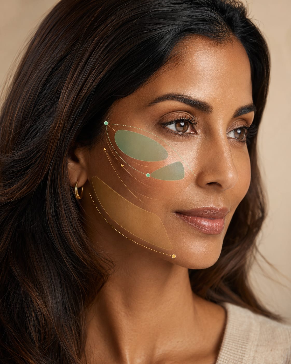Woman with subtle highlights over the cheeks and mid-face support areas for cheek filler Cheek filler for lift, contour and mid-face support.