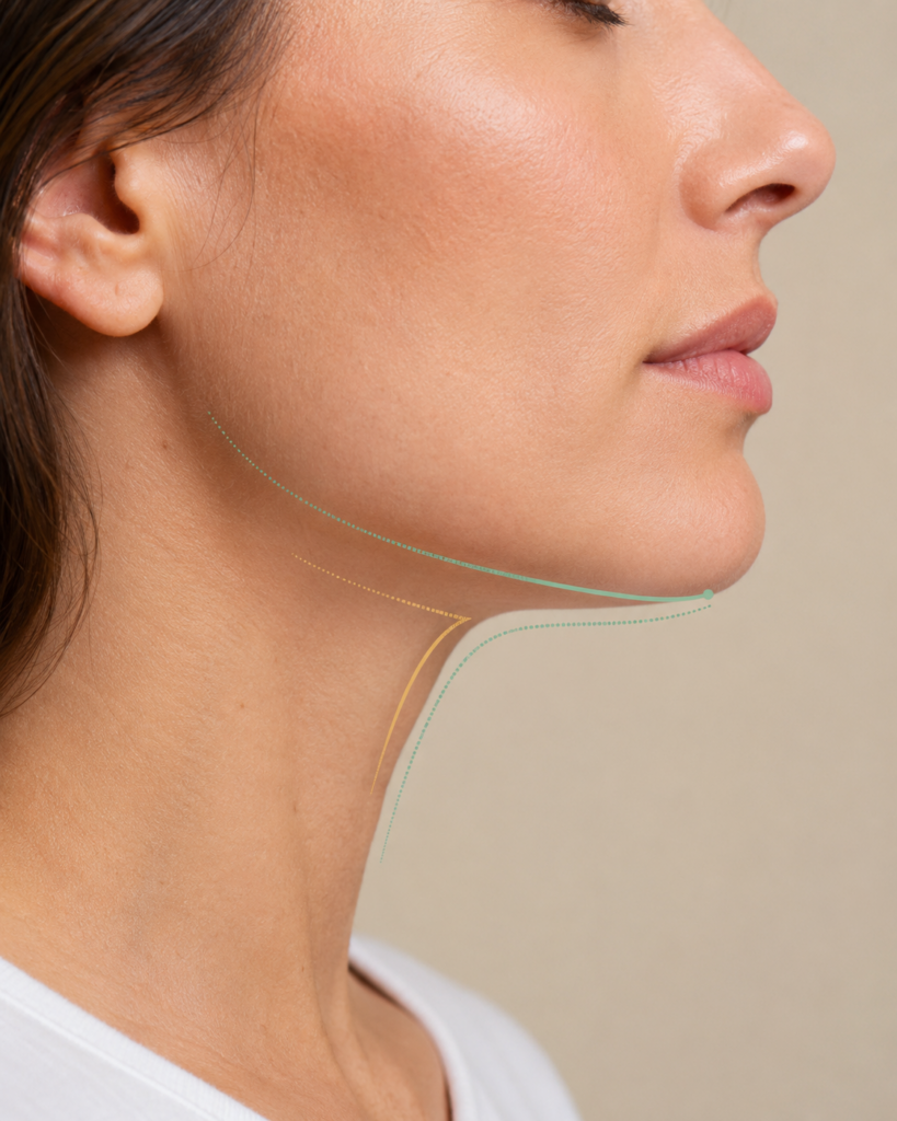 Lower face profile showing natural chin contour and jawline balance at Awlin Beauty Maidstone
