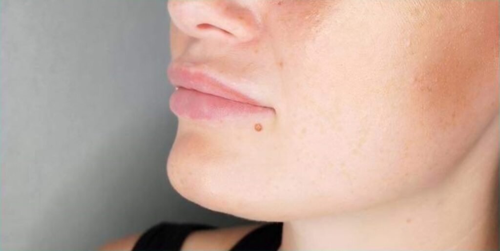 Side profile of a woman's lower face and jawline in Maidstone